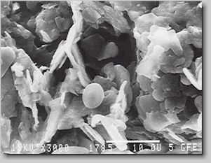 SEM-image of boron nitride powder
